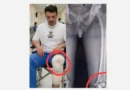 Шок във фитнеса: Дани Петканов изнесен на носилка след сериозна травма